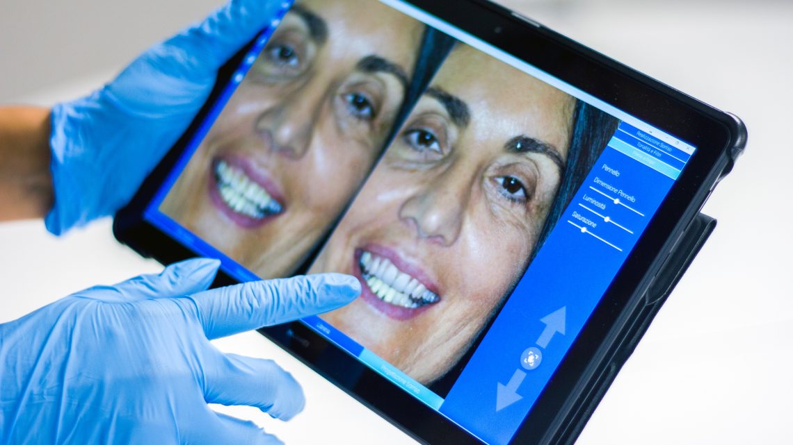 Un orthodontiste explique la croissance du marché des aligneurs de dents invisibles entre 2021 et 2028